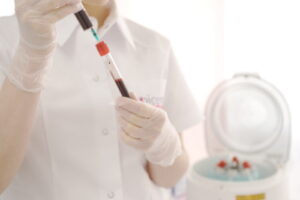 Нужно ли делать плазмолифтинг? Подробнее о процедуре в нашей статье